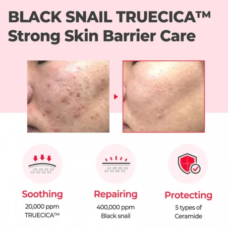 truecica line
