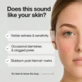 A-Control 10 Azelaic Acid Serum 4