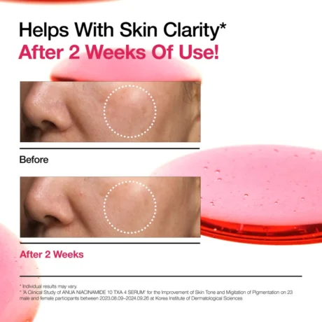 niacinamide txa serum 2025 5