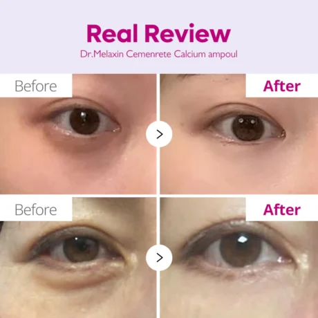 cemenrete calcium intense ampoule plus 4