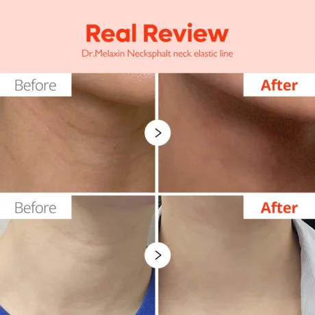 Nexcksphalt-ECM-Neck-Barrier-Ampoule 6