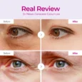 calcium volume eye patch 4
