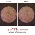 peel shot white rice ampoule 3