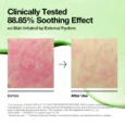 azelaic-10-hyaluron-redness-soothing-pad 11