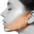 face fit minus band 2