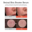 retinal skin booster serum 7