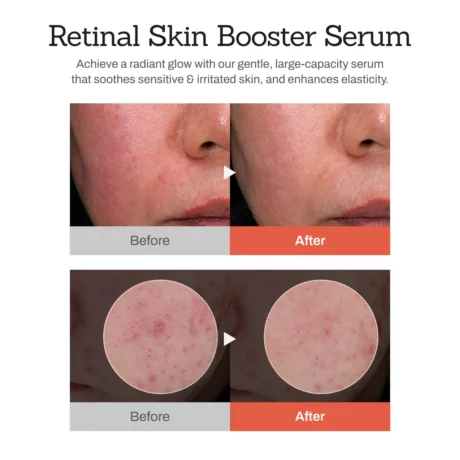 retinal skin booster serum 7