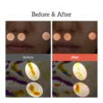 retinal skin booster serum 8