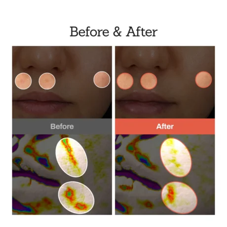 retinal skin booster serum 8