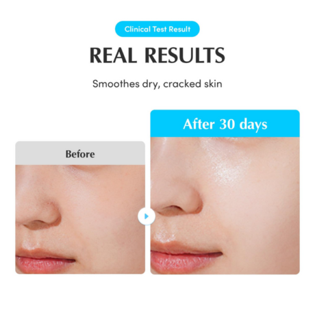 swimming pool ampoule 11