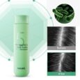 scalp scaling shampoo 300 3