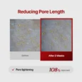 wrinkle fit needle 10