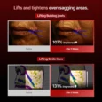 wrinkle fit needle 4