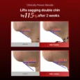 wrinkle fit needle 6