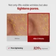 wrinkle fit needle 9