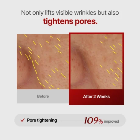wrinkle fit needle 9