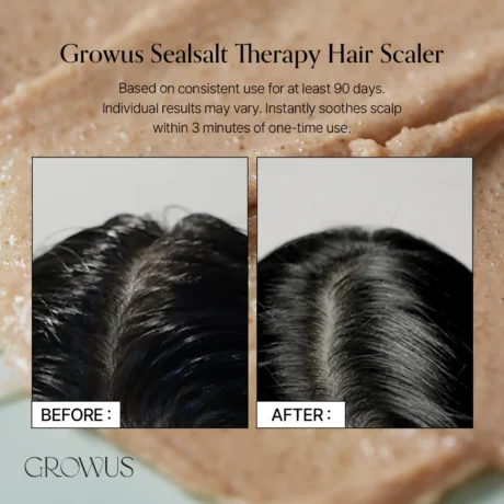 sea salt scapl scaler 06