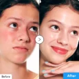 Hyaltoin Flooding Serum 6