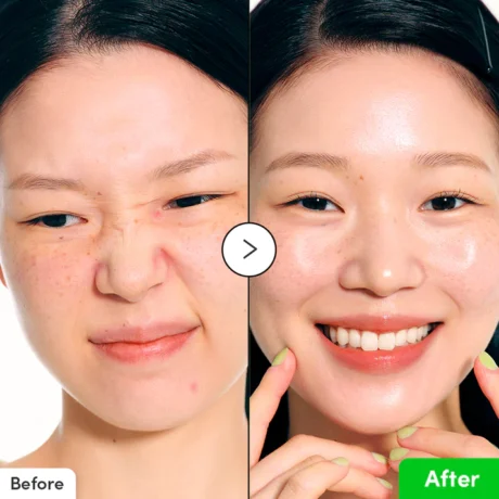 aloe pdrn calming serum 6