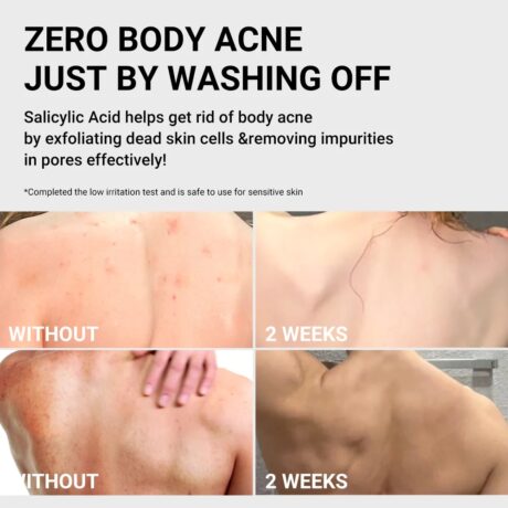 red acne body wash 4