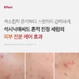 red succinic acid clarifying serum 7