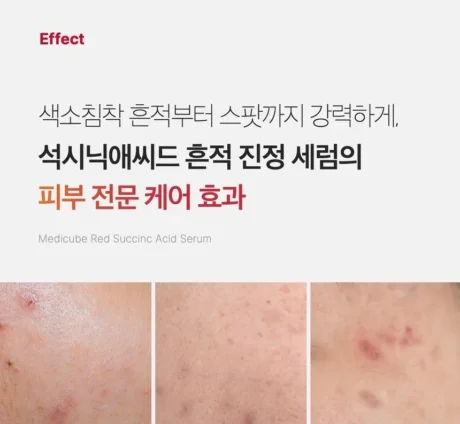red succinic acid clarifying serum 7