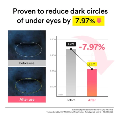 pdrn retinal eye patch 5