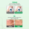 skin barrier dressing mask 7