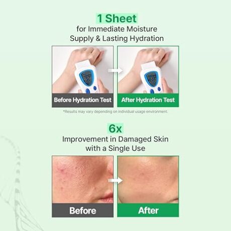 skin barrier dressing mask 7