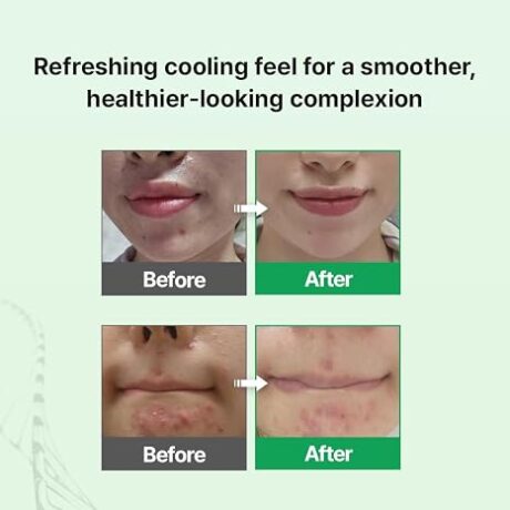 skin barrier hydrating cream 4
