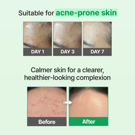 skin barrier intensive cream 8