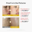 kojic acid turmeric peel shot 6