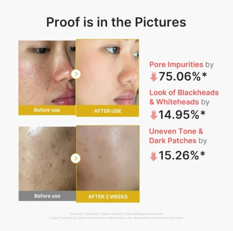 kojic acid turmeric peel shot 6